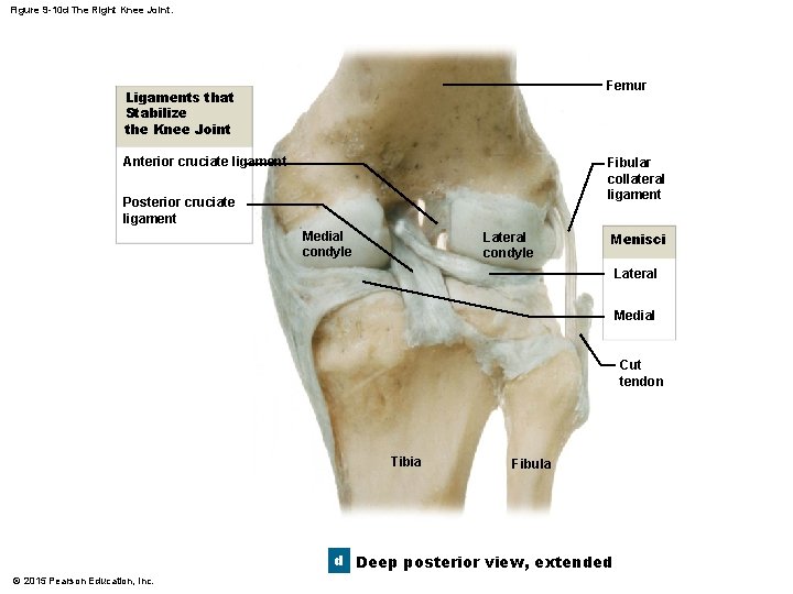 Figure 9 -10 d The Right Knee Joint. Femur Ligaments that Stabilize the Knee Figure 9 -10 d The Right Knee Joint. Femur Ligaments that Stabilize the Knee