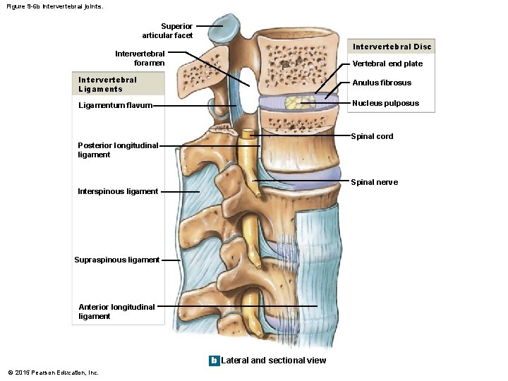 Figure 9 -6 b Intervertebral joints. Superior articular facet Intervertebral Disc Intervertebral foramen Vertebral Figure 9 -6 b Intervertebral joints. Superior articular facet Intervertebral Disc Intervertebral foramen Vertebral