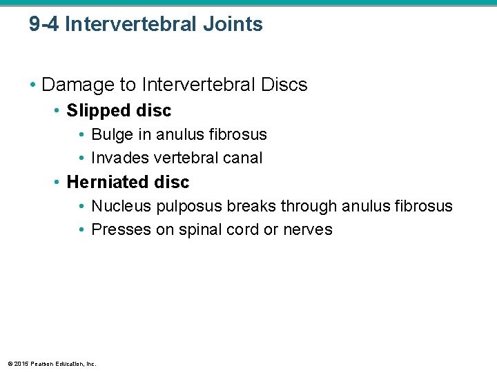 9 -4 Intervertebral Joints • Damage to Intervertebral Discs • Slipped disc • Bulge 9 -4 Intervertebral Joints • Damage to Intervertebral Discs • Slipped disc • Bulge