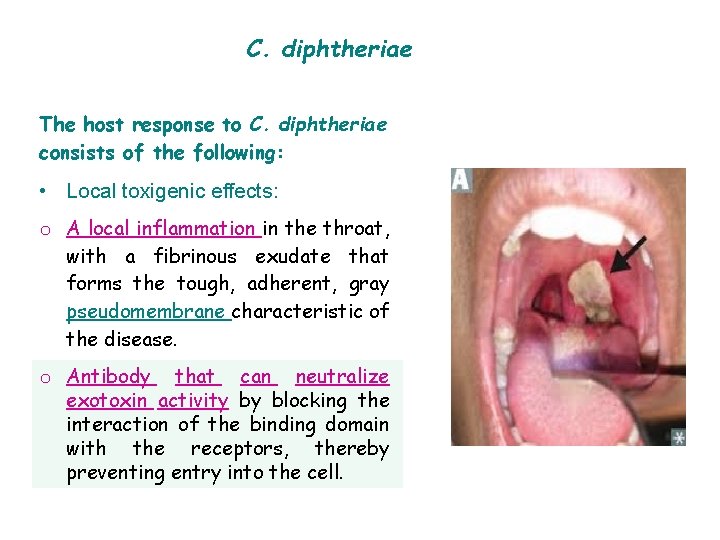 C. diphtheriae The host response to C. diphtheriae consists of the following: • Local