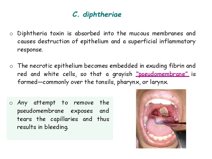 C. diphtheriae o Diphtheria toxin is absorbed into the mucous membranes and causes destruction