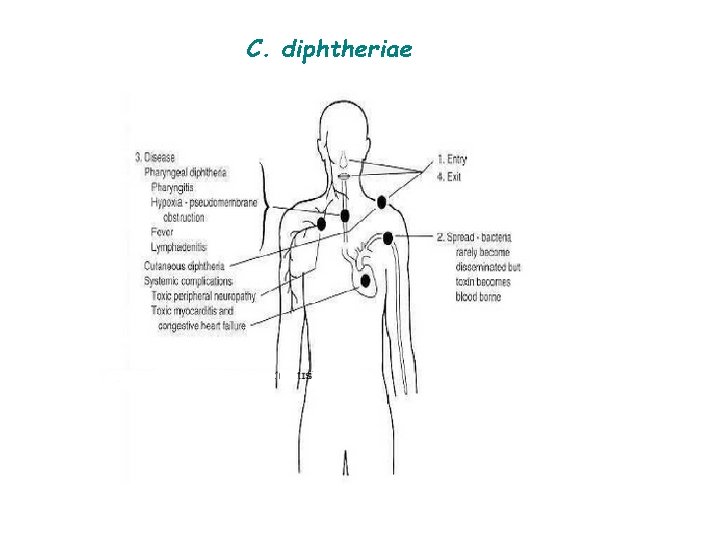 C. diphtheriae 