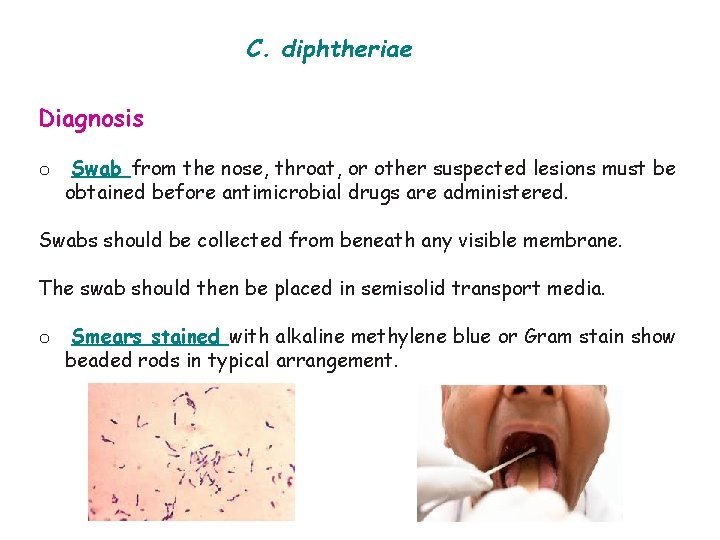 C. diphtheriae Diagnosis o Swab from the nose, throat, or other suspected lesions must