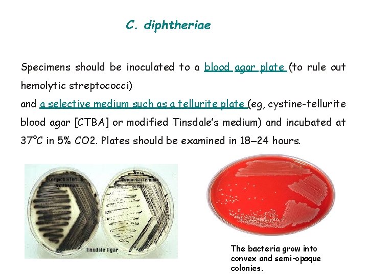 C. diphtheriae Specimens should be inoculated to a blood agar plate (to rule out