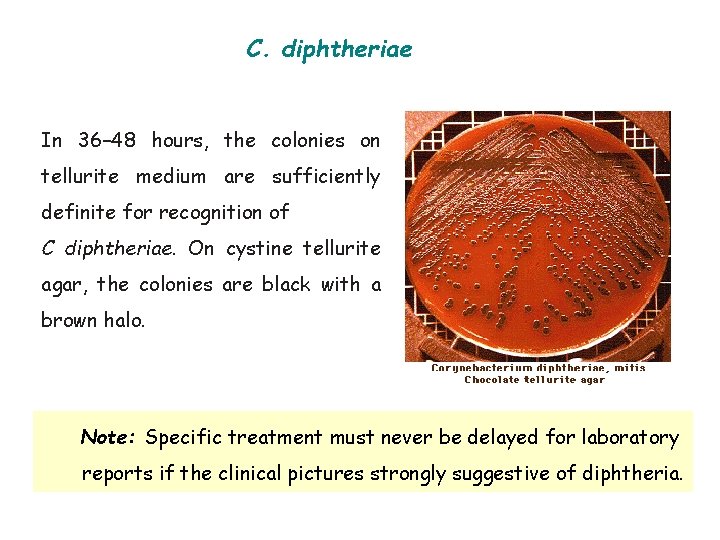 C. diphtheriae In 36– 48 hours, the colonies on tellurite medium are sufficiently definite