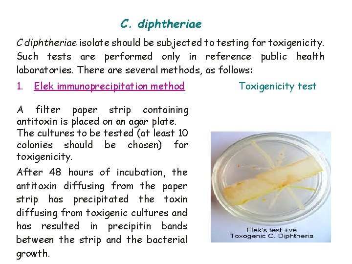 C. diphtheriae C diphtheriae isolate should be subjected to testing for toxigenicity. Such tests