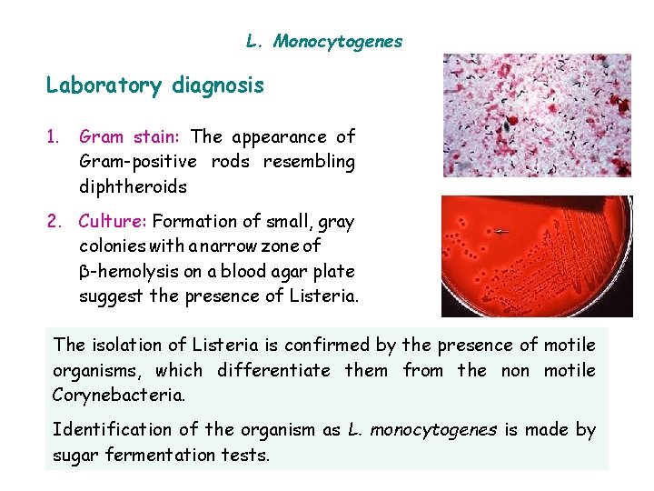 L. Monocytogenes Laboratory diagnosis 1. Gram stain: The appearance of Gram-positive rods resembling diphtheroids