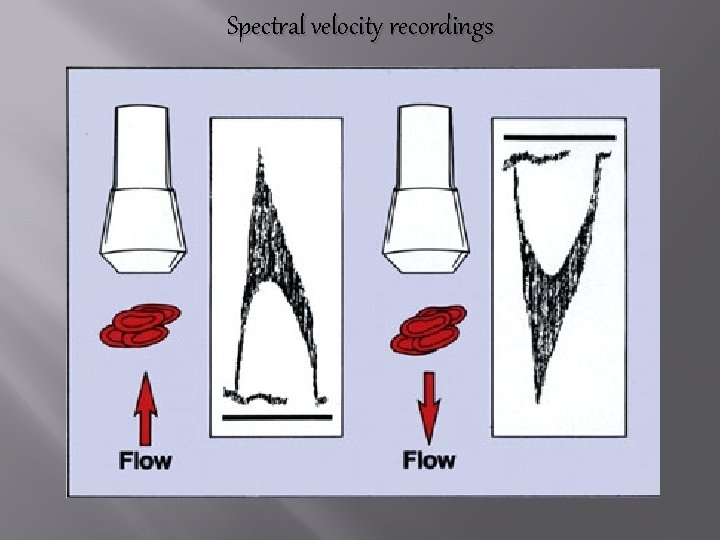 Spectral velocity recordings 