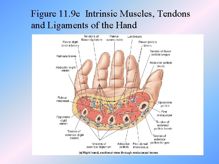 Figure 11. 9 e Intrinsic Muscles, Tendons and Ligaments of the Hand 