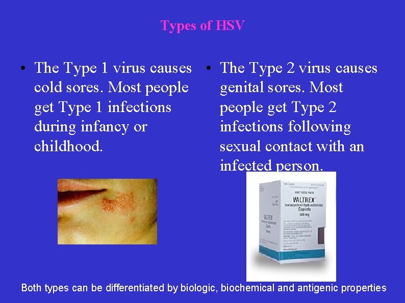 Types of HSV • The Type 1 virus causes • The Type 2 virus