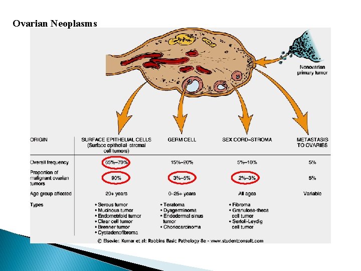 Ovarian Neoplasms 
