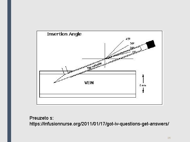 Preuzeto s: https: //infusionnurse. org/2011/01/17/got-iv-questions-get-answers/ 35 