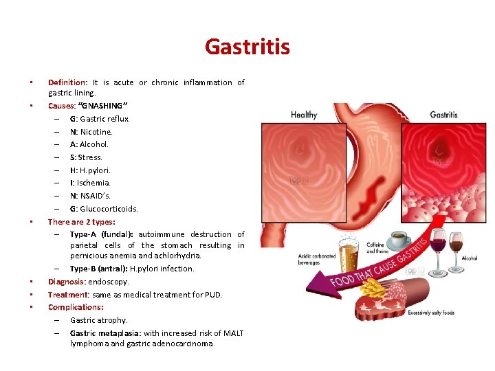 Gastritis • • • Definition: Definition It is acute or chronic inflammation of gastric