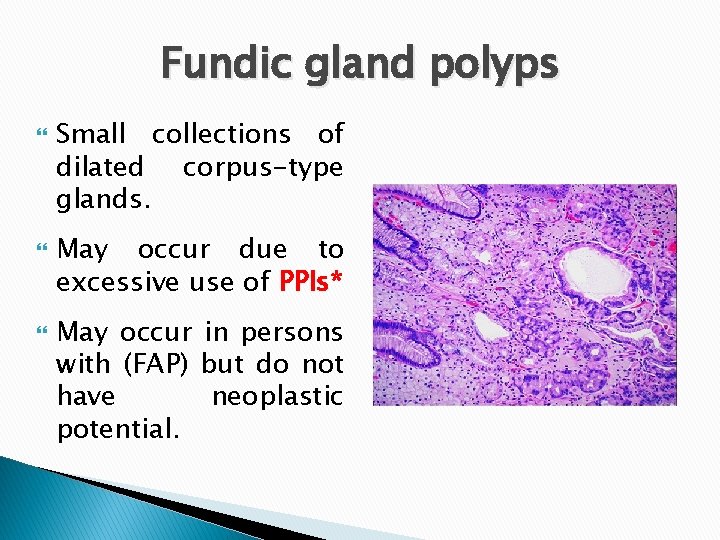 Fundic gland polyps Small collections of dilated corpus-type glands. May occur due to excessive