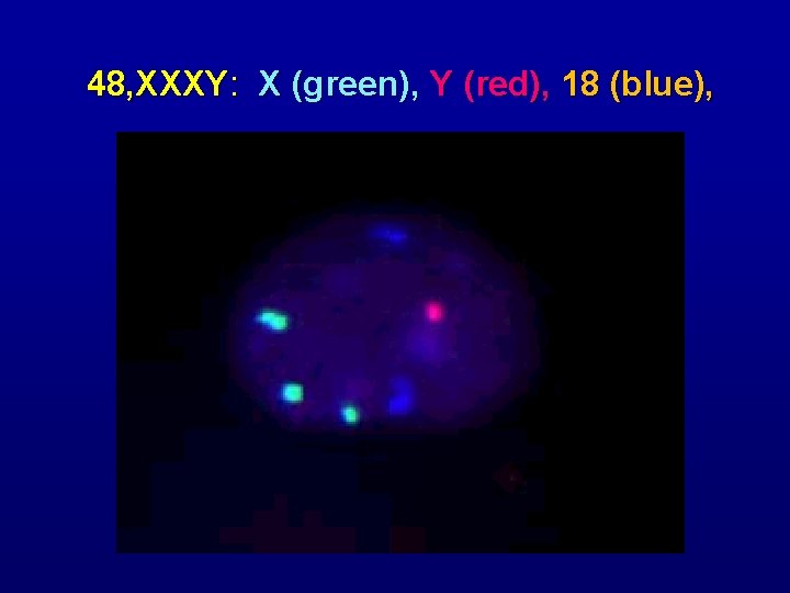 48, XXXY: X (green), Y (red), 18 (blue), 
