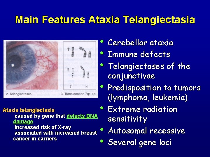Main Features Ataxia Telangiectasia • Cerebellar ataxia • Immune defects • Telangiectases of the