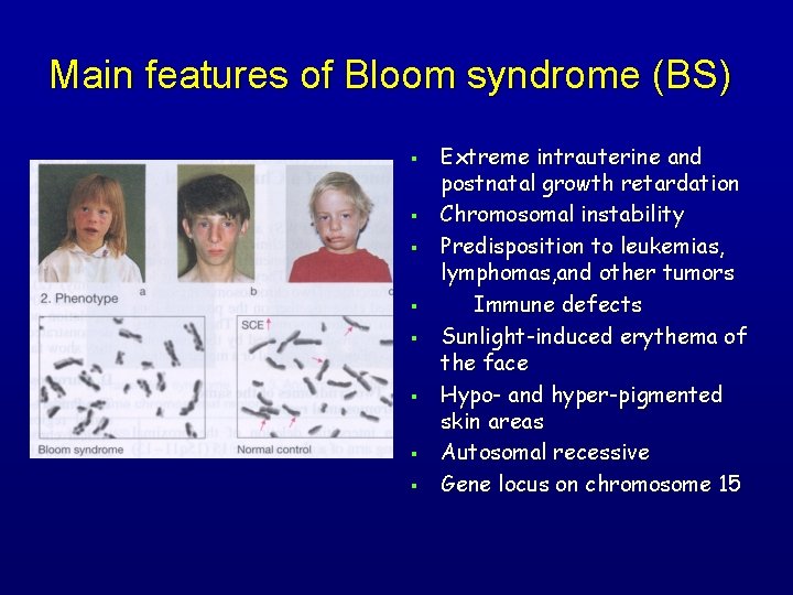 Main features of Bloom syndrome (BS) § § § § Extreme intrauterine and postnatal