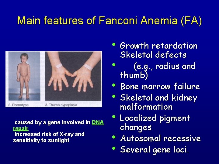 Main features of Fanconi Anemia (FA) • • caused by a gene involved in