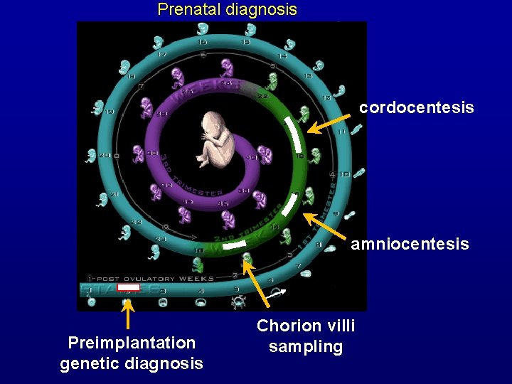 Prenatal diagnosis cordocentesis amniocentesis Preimplantation genetic diagnosis Chorion villi sampling 