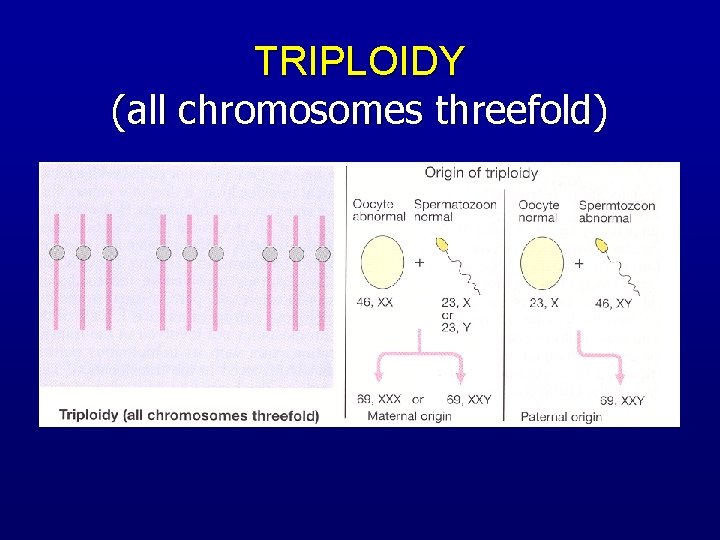 TRIPLOIDY (all chromosomes threefold) 