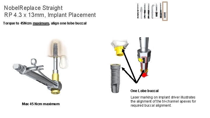 Nobel. Replace Straight RP 4. 3 x 13 mm, Implant Placement Torque to 45