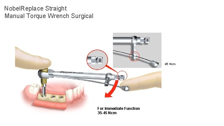 Nobel. Replace Straight Manual Torque Wrench Surgical 45 Ncm For Immediate Function 35 -45