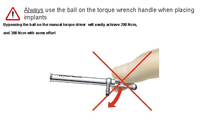 Always use the ball on the torque wrench handle when placing implants Bypassing the