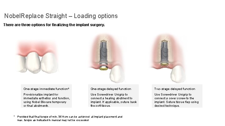 Nobel. Replace Straight – Loading options There are three options for finalizing the implant