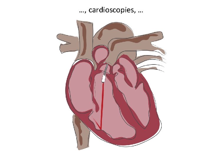 …, cardioscopies, … 