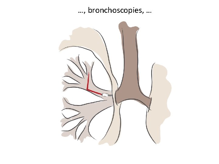…, bronchoscopies, … 