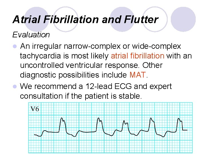 Atrial Fibrillation and Flutter Evaluation l An irregular narrow-complex or wide-complex tachycardia is most