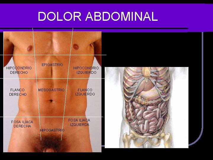 DOLOR ABDOMINAL HIPOCONDRIO DERECHO FLANCO DERECHO EPIGASTRIO MESOGASTRIO HIPOCONDRIO IZQUIERDO FLANCO IZQUIERDO FOSA ILIACA