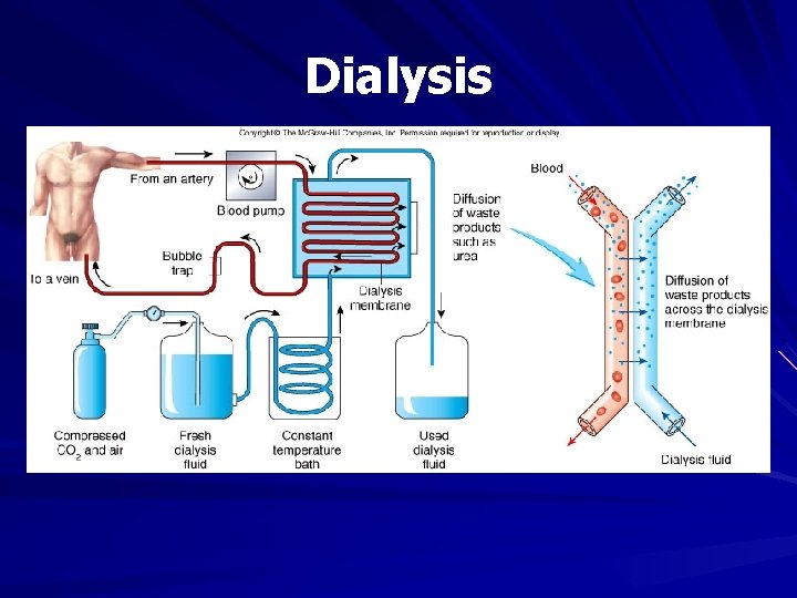 Dialysis 