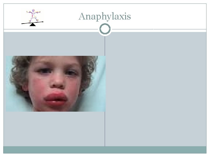 Anaphylaxis 