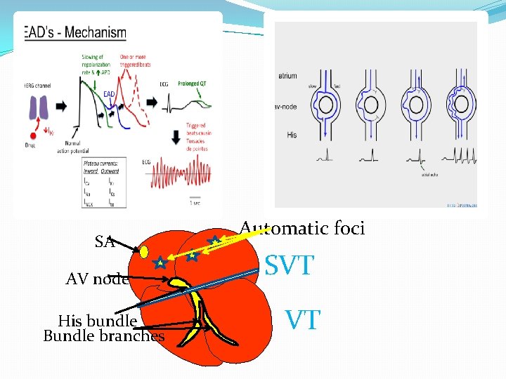 SA AV node His bundle Bundle branches Automatic foci SVT VT 