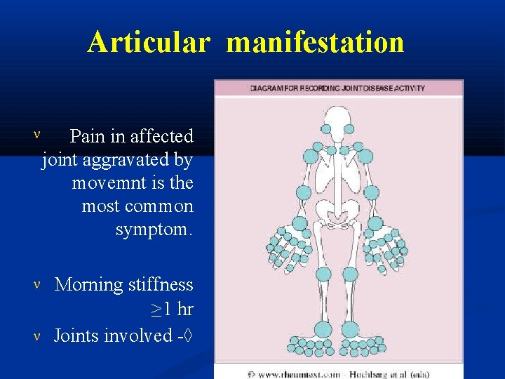 Articular manifestation Pain in affected joint aggravated by movemnt is the most common symptom.