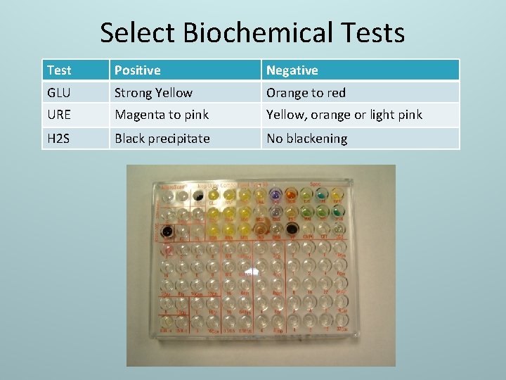 Select Biochemical Tests Test Positive Negative GLU Strong Yellow Orange to red URE Magenta