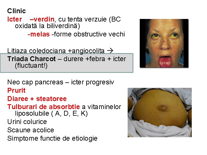 Clinic Icter –verdin, cu tenta verzuie (BC oxidată la biliverdină) -melas -forme obstructive vechi