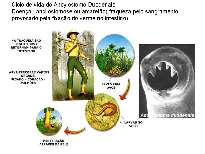 Ciclo de vida do Ancylostomo Duodenale Doença : ancilostomose ou amarelão( fraqueza pelo sangramento