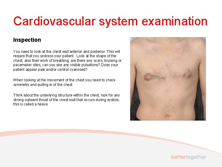 Cardiovascular system examination Inspection You need to look at the chest wall anterior and