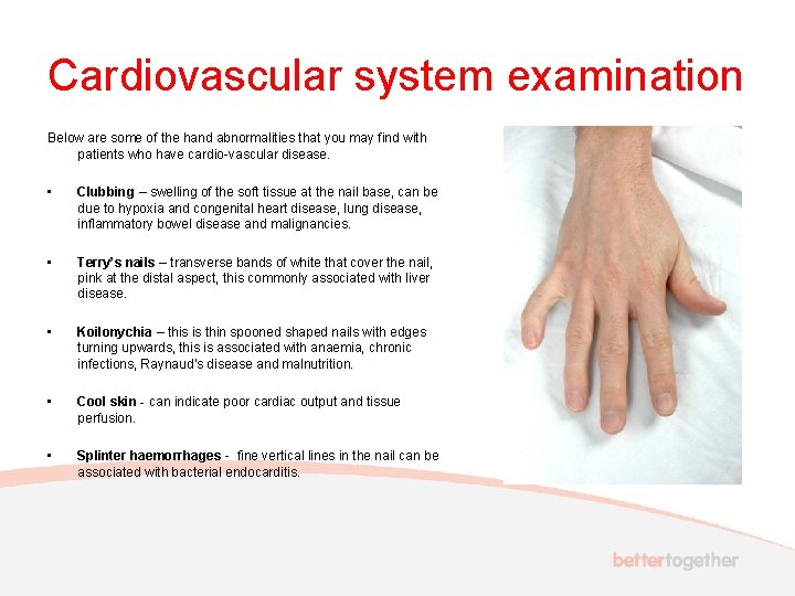 Cardiovascular system examination Below are some of the hand abnormalities that you may find