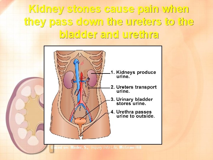 Kidney stones cause pain when they pass down the ureters to the bladder and