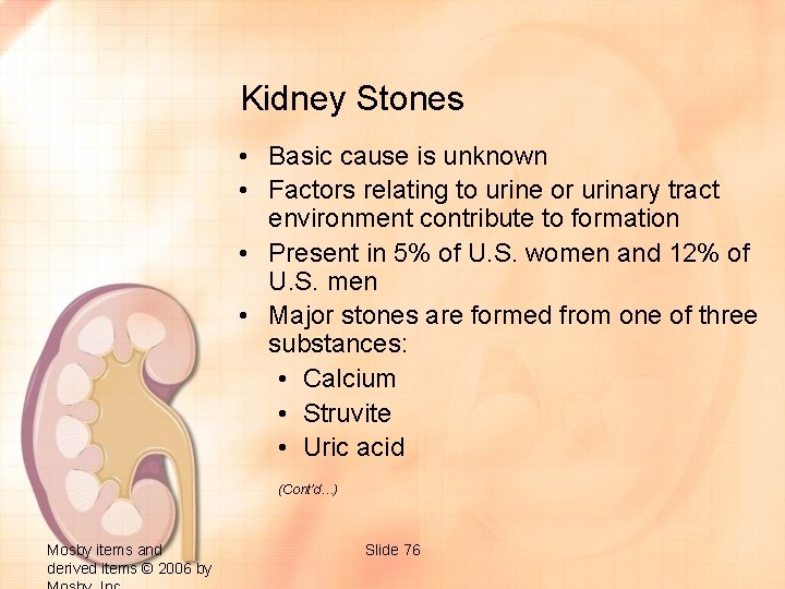 Kidney Stones • Basic cause is unknown • Factors relating to urine or urinary