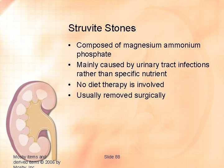 Struvite Stones • Composed of magnesium ammonium phosphate • Mainly caused by urinary tract