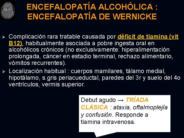 ENCEFALOPATÍA ALCOHÓLICA : ENCEFALOPATÍA DE WERNICKE Ø Ø Complicación rara tratable causada por déficit