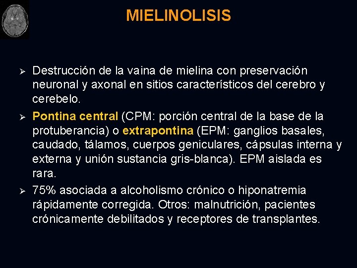 MIELINOLISIS Ø Ø Ø Destrucción de la vaina de mielina con preservación neuronal y