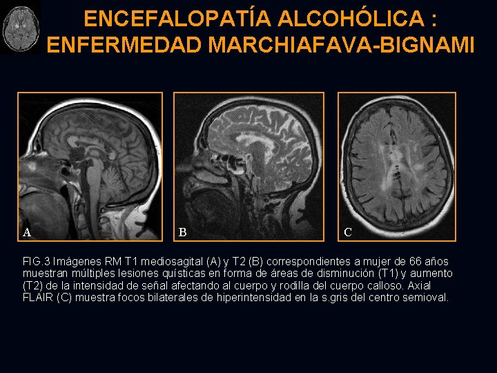 TOXICIDAD CEREBRAL EXPOSICIN ACCIDENTAL E INTENCIONAL REVISIN A