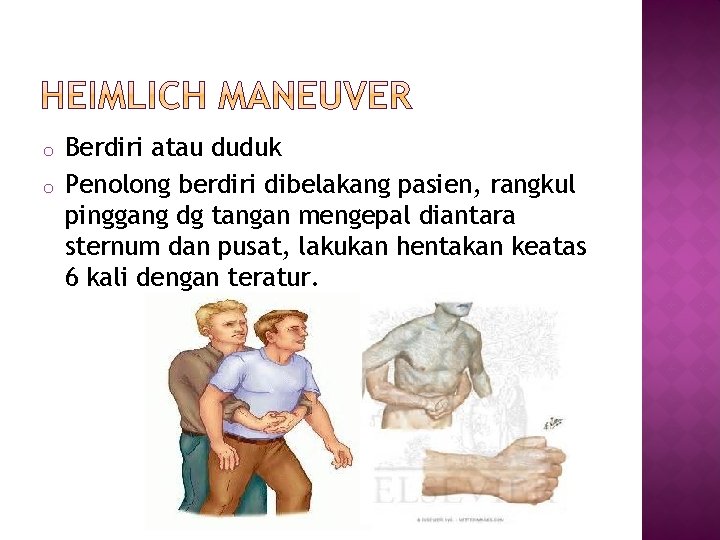 o o Berdiri atau duduk Penolong berdiri dibelakang pasien, rangkul pinggang dg tangan mengepal