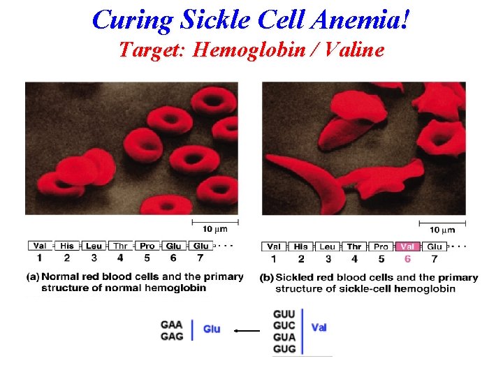Curing Sickle Cell Anemia! Target: Hemoglobin / Valine Curing Sickle Cell Anemia! Target: Hemoglobin / Valine