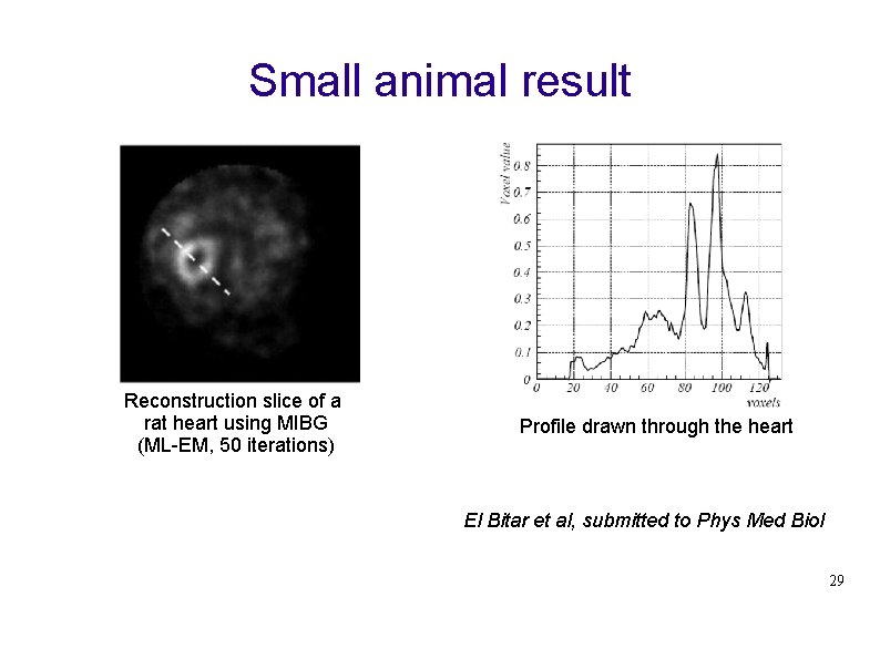 Small animal result Reconstruction slice of a rat heart using MIBG (ML-EM, 50 iterations)